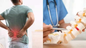 Is It Back Pain or a Slipped Disc? Key Differences and When to Seek Help