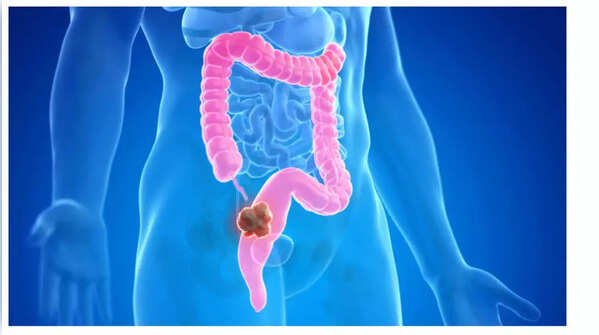 Depiction of rapid weight loss.