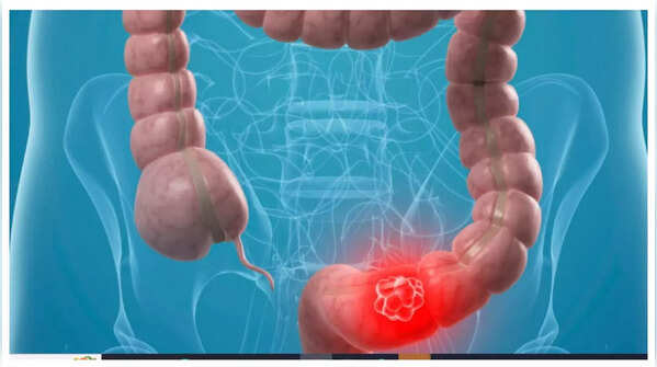 Abdominal pain.